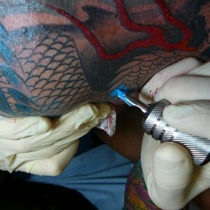 Read more about the article What are the risks of tattoo laser removal?